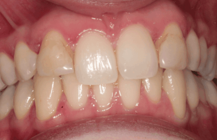 Before - dentblanche